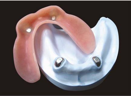 Acrylic denture product image 1
