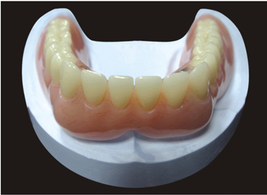 Acrylic denture product image 2