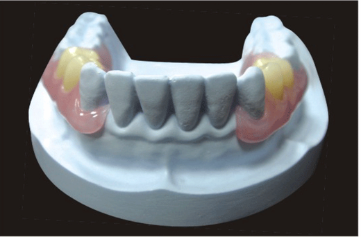 Acrylic denture product image 4