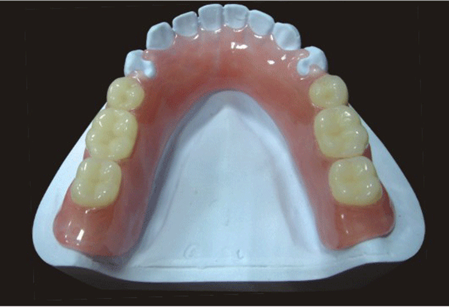 Acrylic denture product image 5