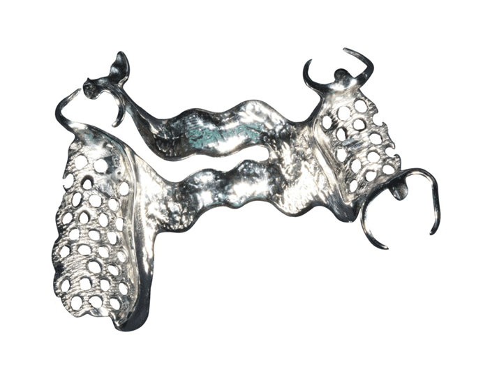 Cast partial framework product image 4