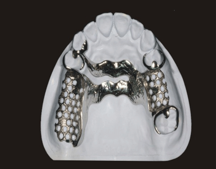Cast partial framework product image 5