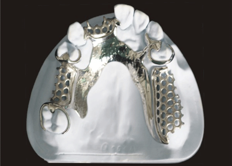 Cast partial framework product image 6