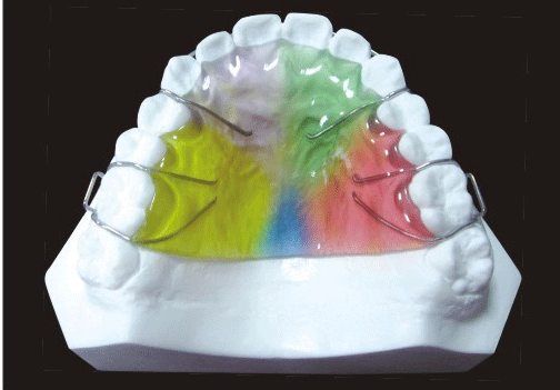 Retainer and orthodontic appliance product image 1